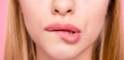 تشقّق الشفاه يمكن أن يكون سببه صحيّاً  960932 large  - زاجل نيوز