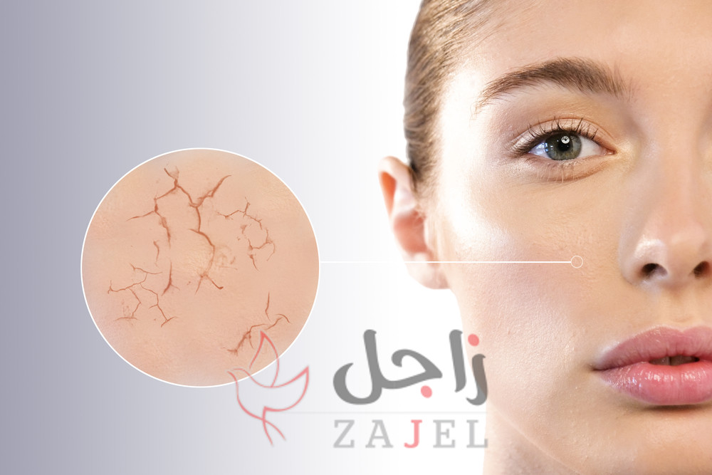 GGGGGGGH - زاجل نيوز