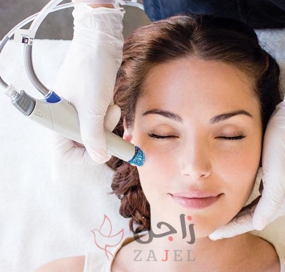 زاجل الجماااااااال يي - زاجل نيوز