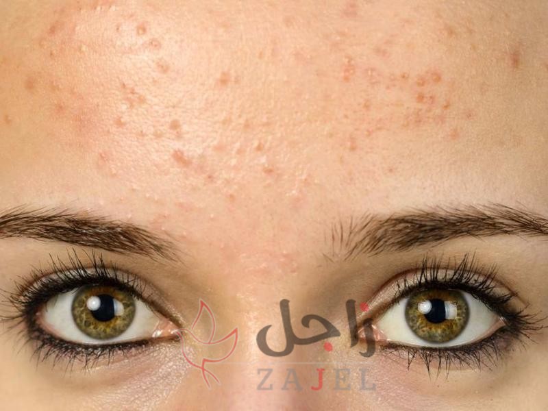 زاجل الجمال بوم - زاجل نيوز