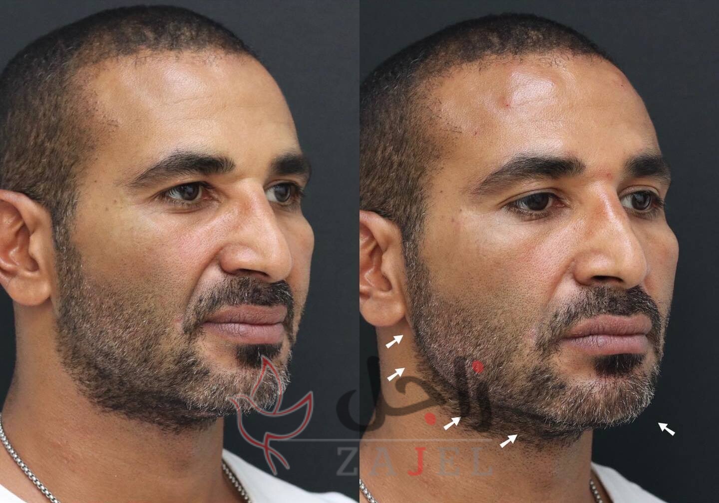 4 304 1 - زاجل نيوز