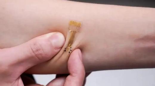 “ضمّادة ذكية” توصل الدواء بدقة وتسرّع إصلاح الأنسجة