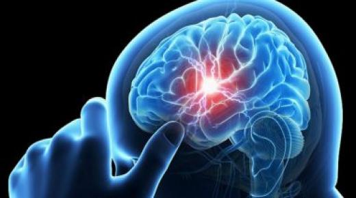 7 أعراض صامتة للجلطة انتبه إليها.. منها التنميل وتشنجات الساق