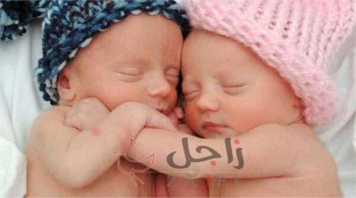 أنواع التوائم المتلاصقة