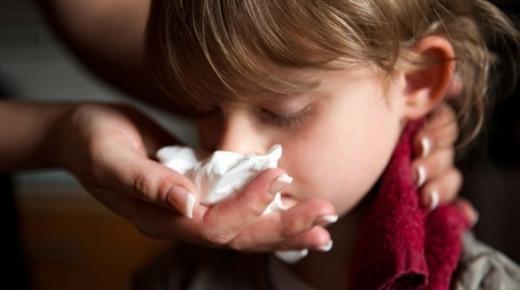 أسباب نزيف الأنف لدى الأطفال