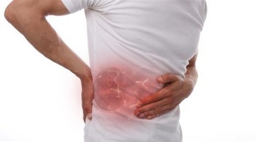 هكذا تفرّق بين آلام الكلى والظهر