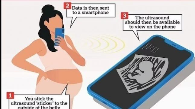 تقنية جديدة تمكن الحوامل من متابعة نمو أجنتهن على هواتفهن