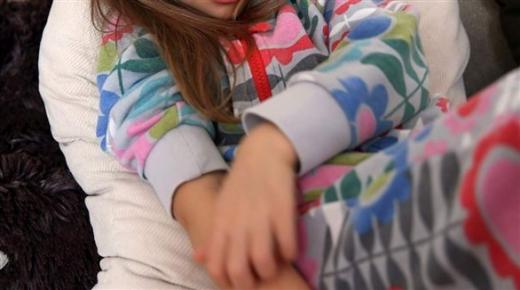 أسباب الحساسية التلامسية لدى الأطفال وأعراضها