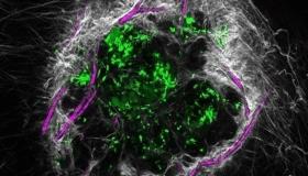 اكتشاف جديد يفتح الباب أمام شفاء الجروح الصعبة