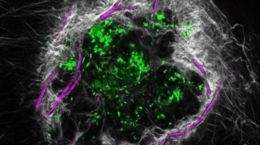 اكتشاف جديد يفتح الباب أمام شفاء الجروح الصعبة