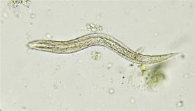 لماذا يصاب الأطفال بالديدان كثيراً؟
