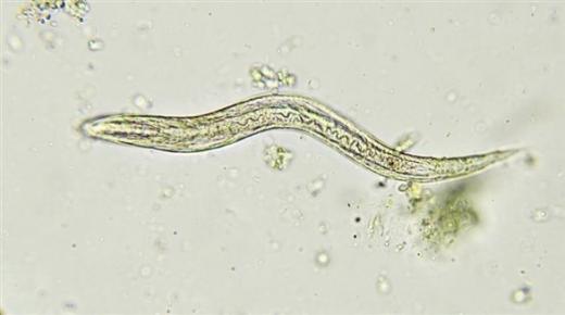 لماذا يصاب الأطفال بالديدان كثيراً؟