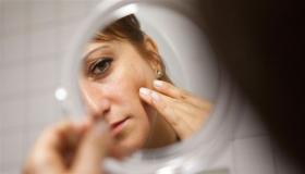 التغذية غير الصحية تظهر على الوجه