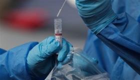 الوزن الزائد يزيد خطر كورونا