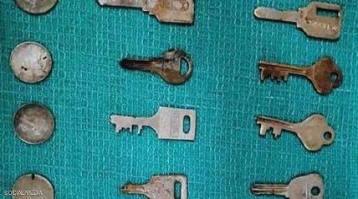 مفاتيح وعملات وشفرة في معدة رجل