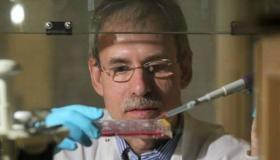 مسحة لتحديد شيخوخة الجلد المبكرة