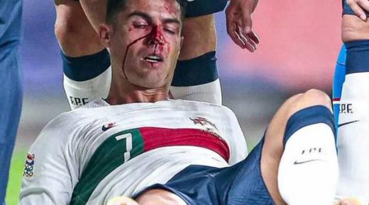 رونالدو يتعرض لإصابة شديدة خلال مباراة البرتغال والتشيك