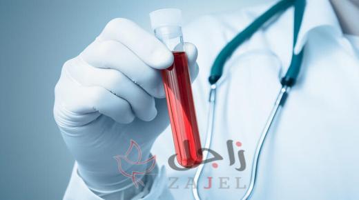 أعراض نقص الصفائح الدموية منها ظهور كدمات على الجسم