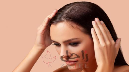 للشعر الخفيف استخدمي خلطة البصل والثوم