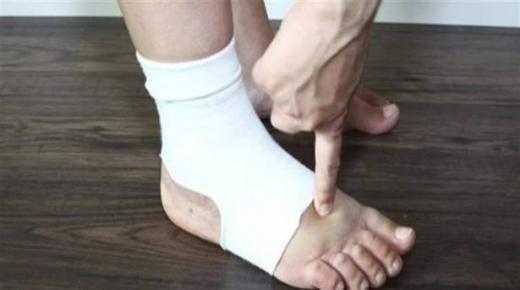 ما العلاقة بين البوتاسيوم والملح وتورّم القدمين؟