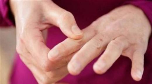 تعانون من الروماتيزم؟ اليكم هذه المأكولات المساعدة