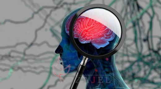 بروتين “طبيعي” في أدمغتنا يحمينا من ألزهايمر