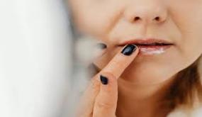 لماذا تُسبب مرطبات الشفاه والكريمات جفاف الشفاه واليدين؟ وكيف تختارين ما يُنقذها؟