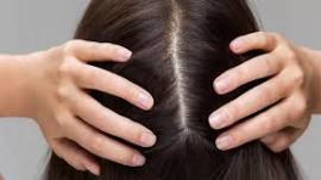 هل يمكن تعويد فروة الرأس الدهنية على غسلها بوتيرة أقل؟