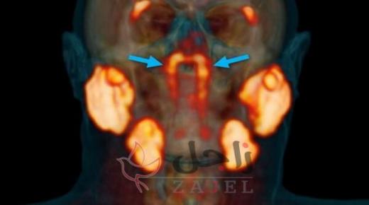 غدد جديدة تم اكتشافها  في جسم الإنسان لم تكن معروفة فيما مضى