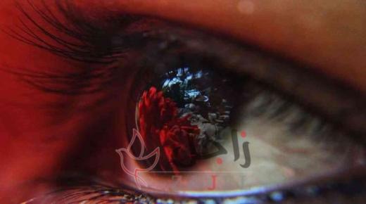 معرفة اذا كانت مستويات الكوليسترول مرتفعة من خلال علامة دالة في العين