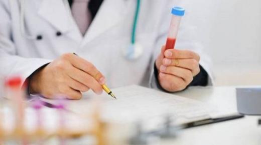 علماء يتوصلون لهرمون يقي السيدات من سرطان الكبد!