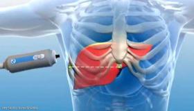 إذا شعرت بهذا في الليل.. فأنت بحاجة إلى فحص الكبد