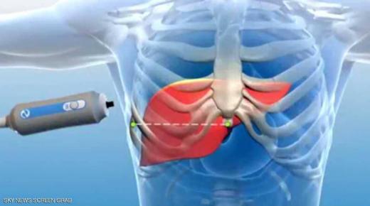 إذا شعرت بهذا في الليل.. فأنت بحاجة إلى فحص الكبد