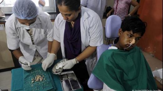 اقتلاع 526 ضرساً وسناً من فم طفل