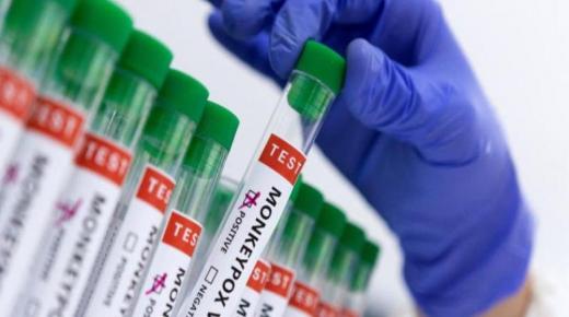 جدري القردة في المغرب