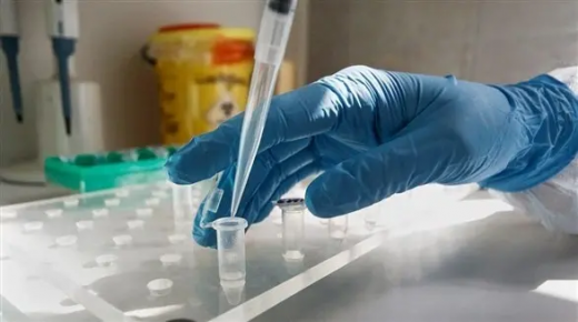 10,136 حالة كورونا حصيلة 24 ساعة في اوكرانيا