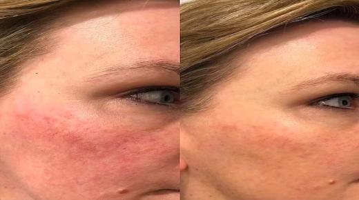 كيف تحصلين على بشرة متألقة في كل عقد من عمرك؟