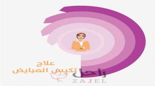 علاج تكيّس المبايض بالأعشاب والأدوية وأسبابه