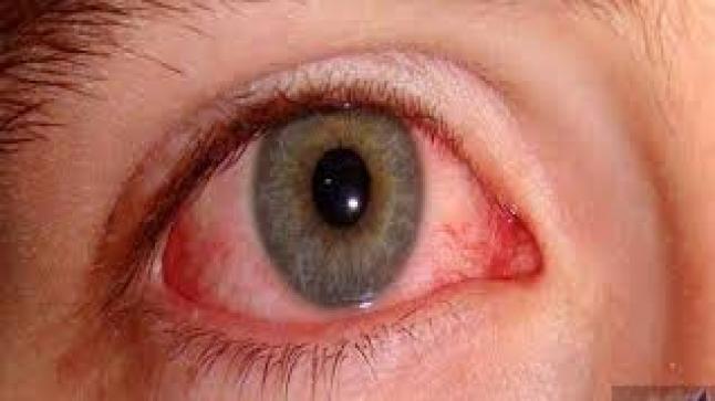10 إجراءات تعزز الوقاية من إصابات العين