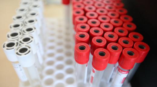 حالات COVID-19 في العالم تجاوز 229.2 مليون