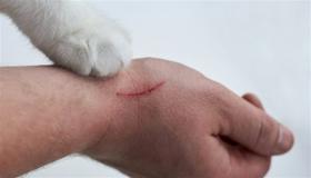 طبيب أردني: خدش قطة كاد أن يدمّر طفلة.. والتشخيص أنقذها بـ5 دنانير