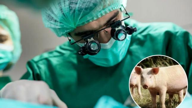 أول زراعة ناجحة لرئة خنزير في صدر إنسان لـ9 أيام