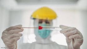 طبيب أردني يوضح حول متحور (EG.5) المنتشر بالعالم