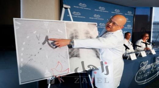 استبدال رئتي مراهق بعد تلفهما بسبب السجائر الإلكترونية