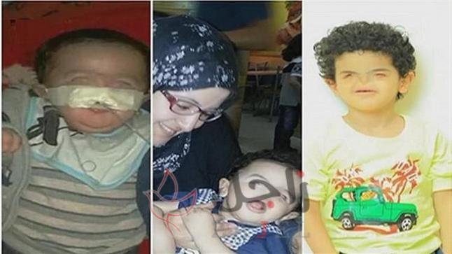 أول طفل مصري يولد بدون أنف يتحول لـ «موديل».. والدة محمد: «تعرضت للتنمر والناس كانت شايفاه كائن فضائي»