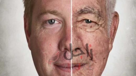 علامات تقدم السن