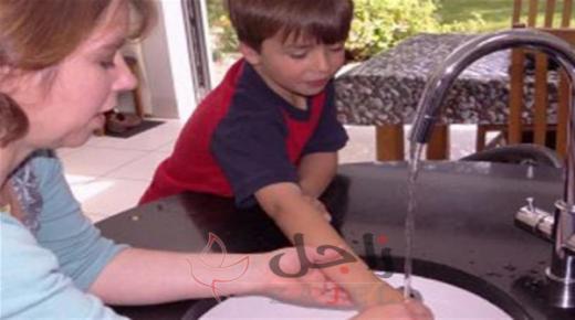 كيف تتصرفين اذا انسكب مشروب ساخن على جلد طفلك