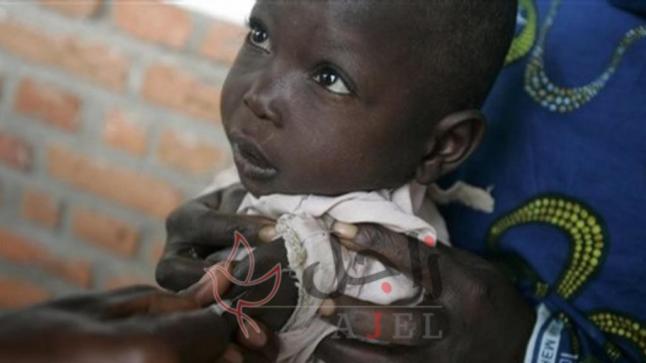 الحصبة تودي بحياة 6 آلاف شخص في الكونغو