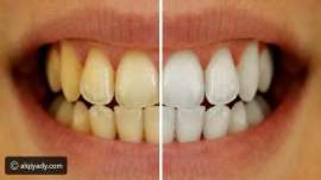 أسباب اصفرار الاسنان وطرق العلاج