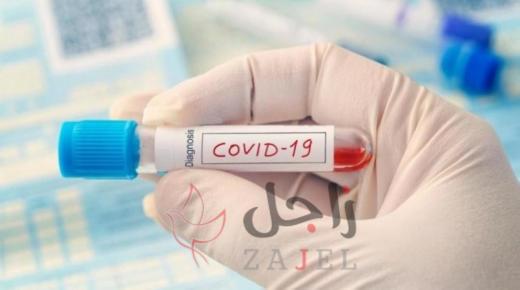 أميركا: 1997 وفاة بفيروس كورونا خلال 24 ساعة